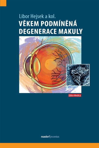 Levně Věkem podmíněná degenerace makuly