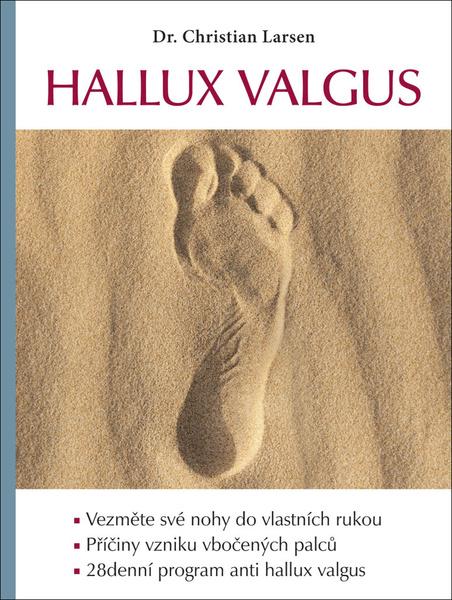 Hallux valgus - 9788088395201