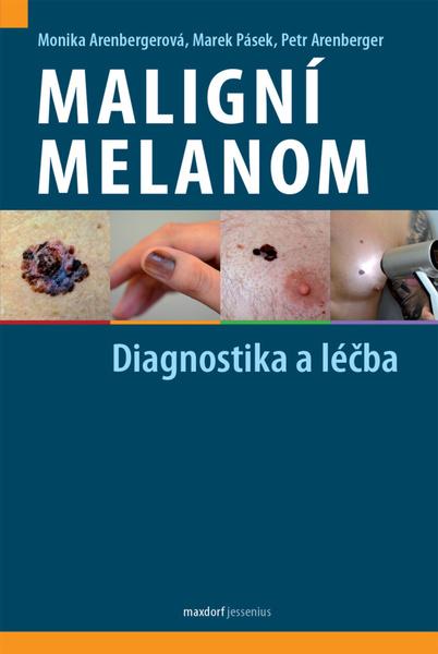 Maligní melanom - 9788073457501