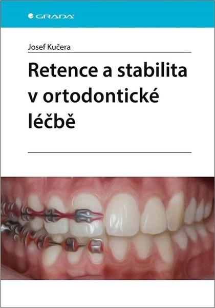 Levně Retence a stabilita v ortodontické léčbě