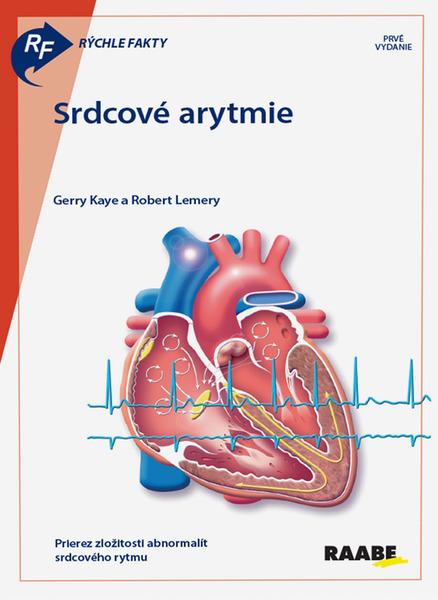 Srdcové arytmie - 9788081408137