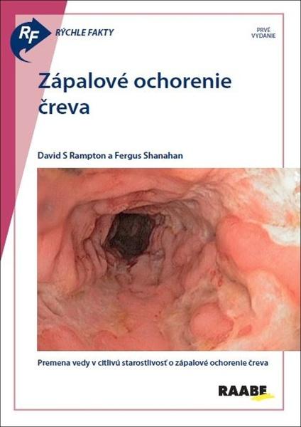 Rýchle fakty: Zápalové ochorenie čreva - 9788081407314