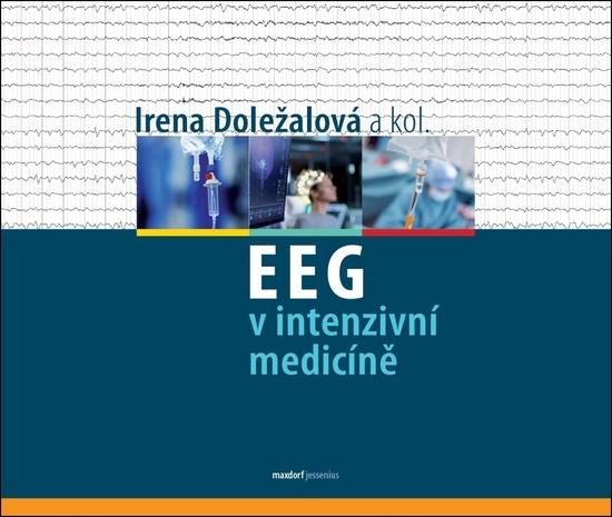 Levně EEG v intenzivní medicíně