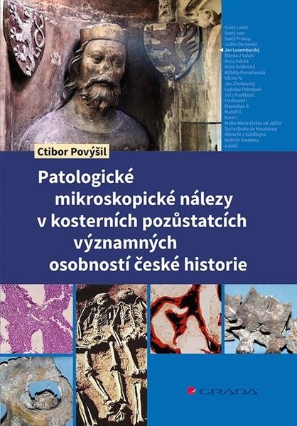 Patologické mikroskopické nálezy v kosterních pozůstatcích významných osobností - 9788027151912