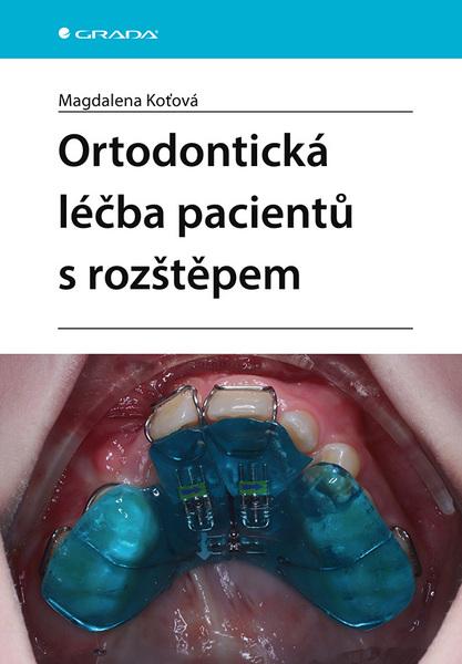 Levně Ortodontická léčba pacientů s rozštěpem