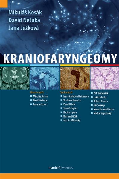 Levně Kraniofaryngeomy
