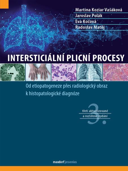 Levně Intersticiální plicní procesy