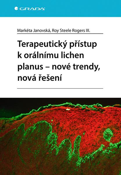 Levně Terapeutický přístup k orálnímu lichen planus - nové trendy, nová řešení