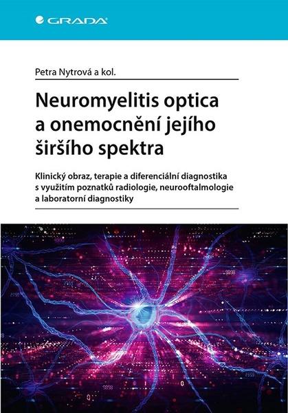 Neuromyelitis optica a poruchy jejího šišího spektra - 9788027152032