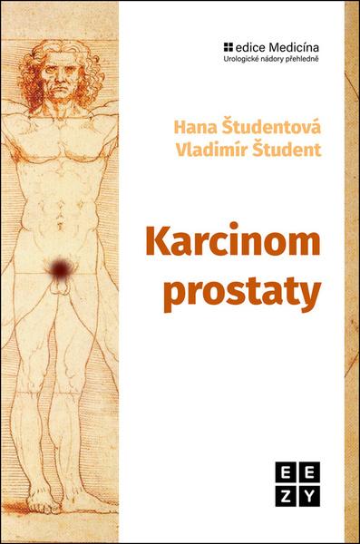 Karcinom prostaty - 9788088506324