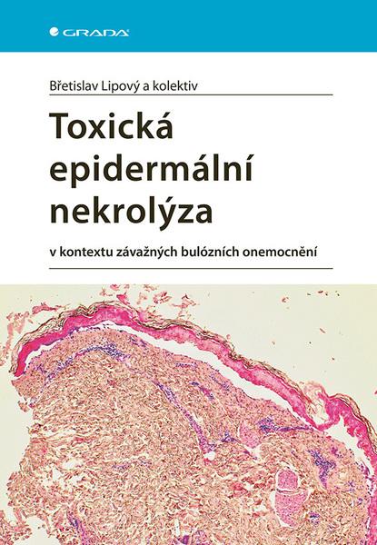 Levně Toxická epidermální nekrolýza