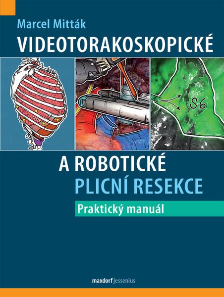 Levně Videotorakoskopické a robotické plicní resekce