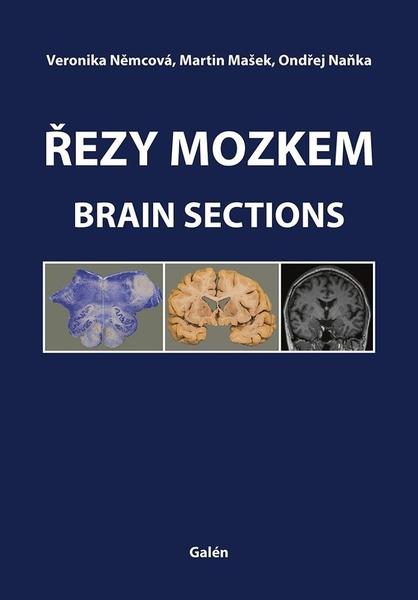 Levně Řezy mozkem