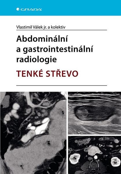 Levně Abdominální a gastrointestinální radiolologie