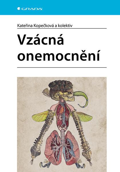 Levně Vzácná onemocnění