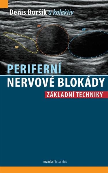 Levně Periferní nervové blokády