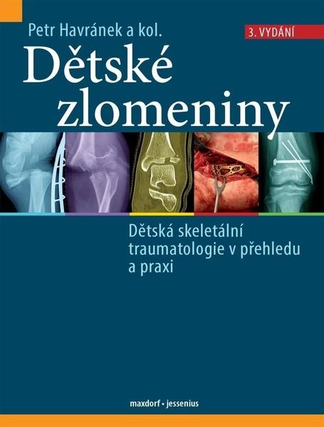 Levně Dětské zlomeniny