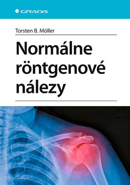 Normálne röntgenové nálezy - 9788080909031