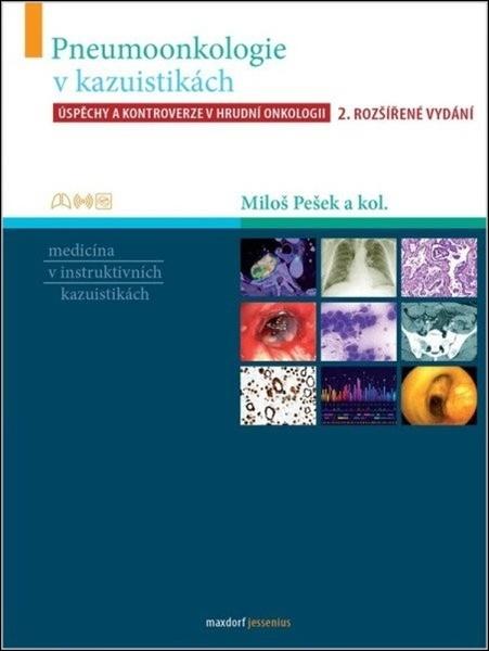 Pneumoonkologie v kazuistikách - 9788073458492