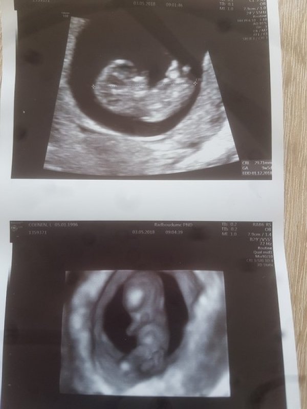 Afbeelding blog 'Baby 2# Deel 1'