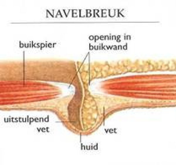 branderig gevoel buik