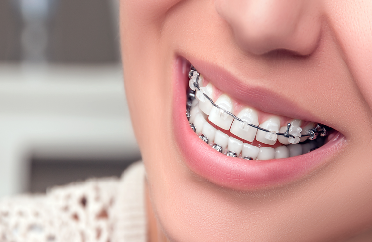 Blog header image