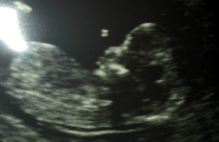Blog header image