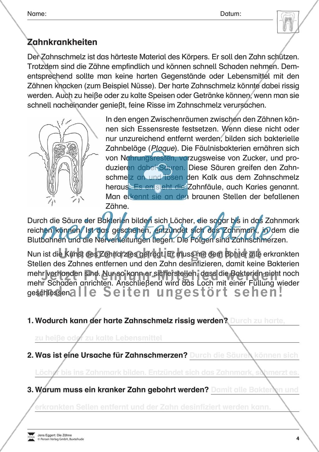 Die Zähne Preview 5