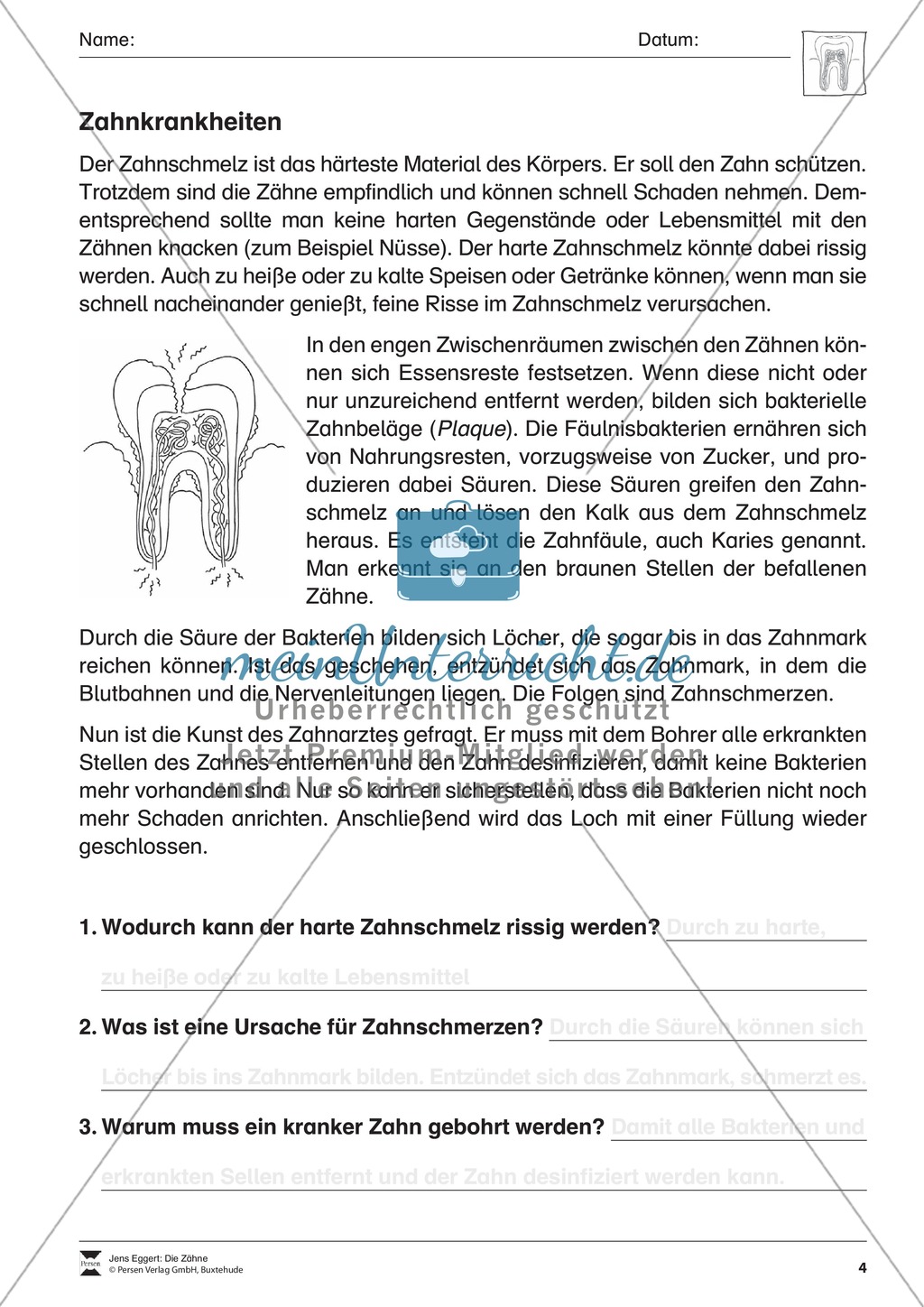 Zahnkrankheiten: Text + Übungen Preview 1