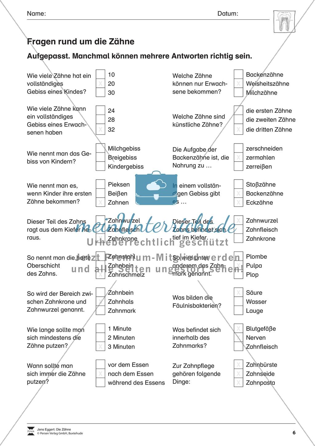 Fragen rund um Zähne: Übungen (Multiple Choice) Preview 1