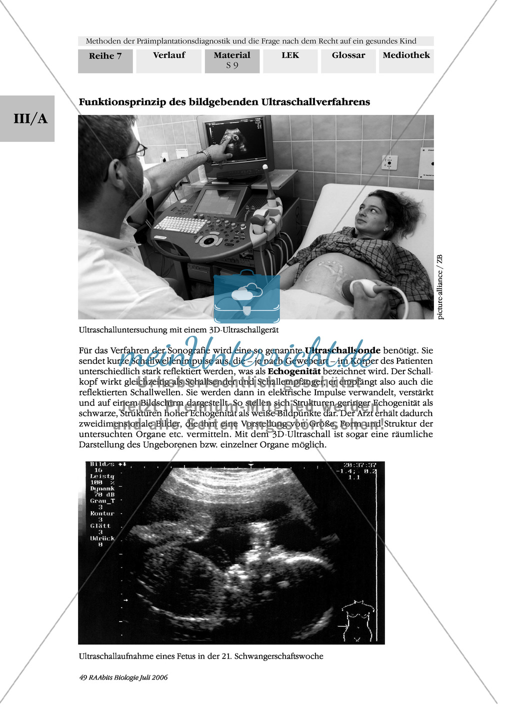 Text zur Entwicklung der befruchteten Eizelle und Gruppenpuzzle zur Präimplantationsdiagnostik und Pränataldiagnostik Preview 7