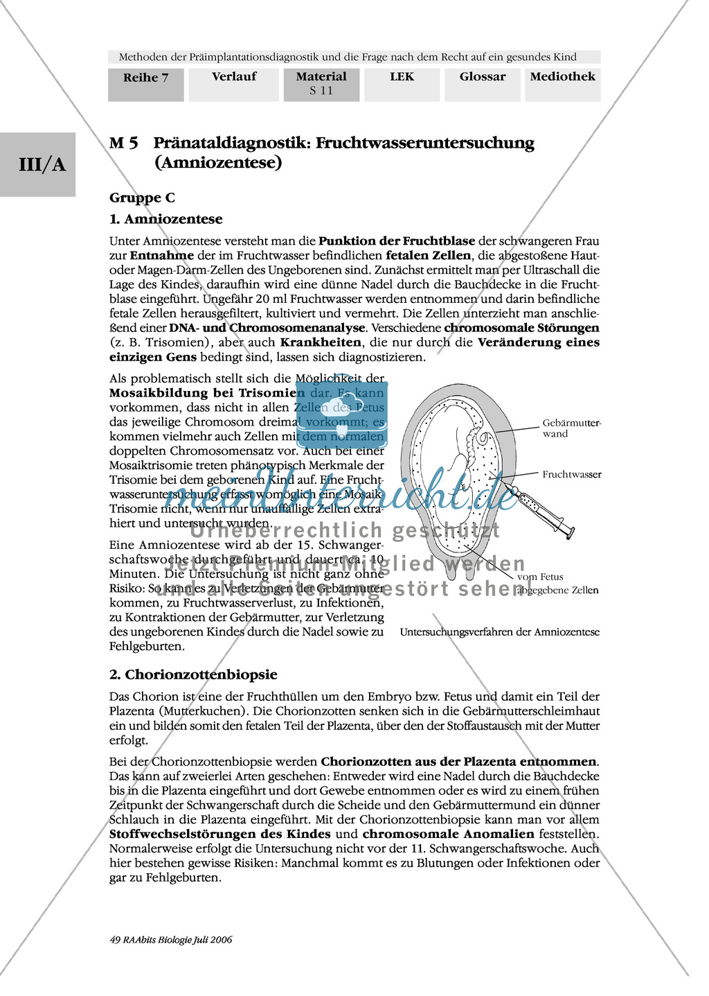 Text zur Entwicklung der befruchteten Eizelle und Gruppenpuzzle zur Präimplantationsdiagnostik und Pränataldiagnostik Preview 9