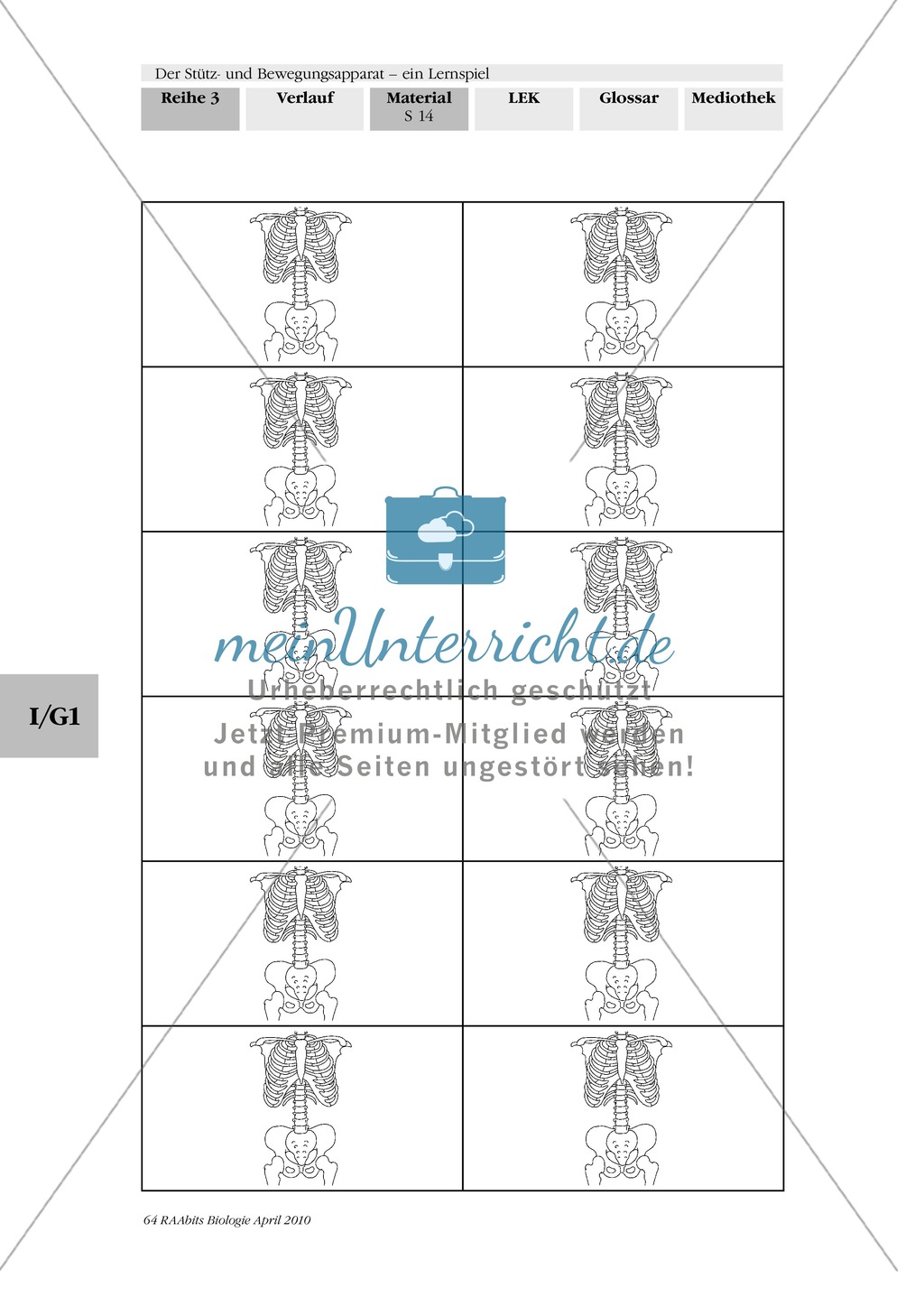 Lernspiel zum Stütz- und Bewegungsapparat: Spielanleitung, Spielfeld, Skelett-Puzzleteile, Fragen, Spielkarten, Röntgenbilder Kontrollbogen, Lösungsbogen Preview 13