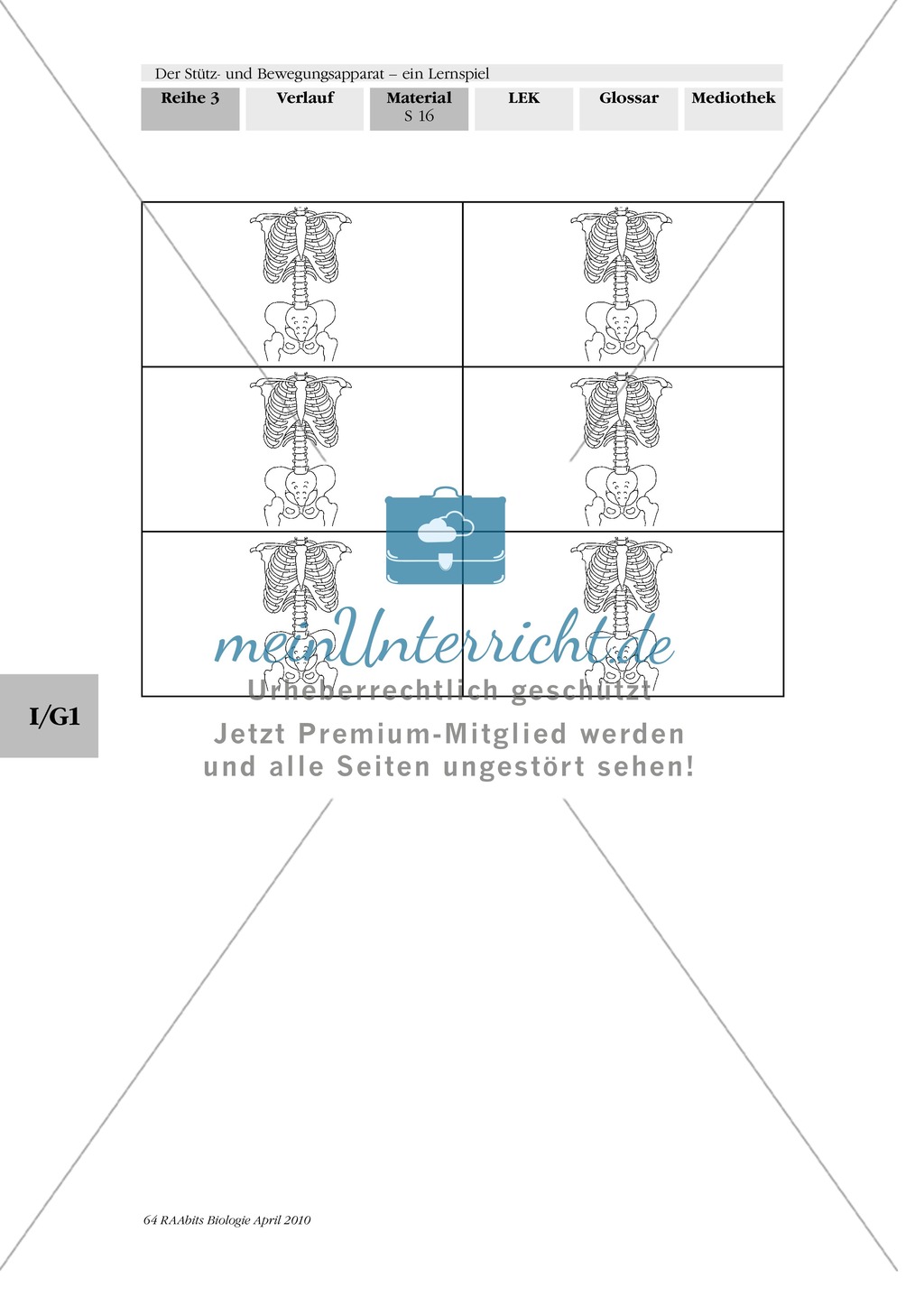 Lernspiel zum Stütz- und Bewegungsapparat: Spielanleitung, Spielfeld, Skelett-Puzzleteile, Fragen, Spielkarten, Röntgenbilder Kontrollbogen, Lösungsbogen Preview 15
