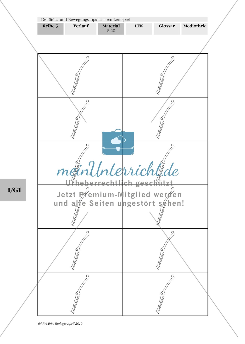 Lernspiel zum Stütz- und Bewegungsapparat: Spielanleitung, Spielfeld, Skelett-Puzzleteile, Fragen, Spielkarten, Röntgenbilder Kontrollbogen, Lösungsbogen Preview 19