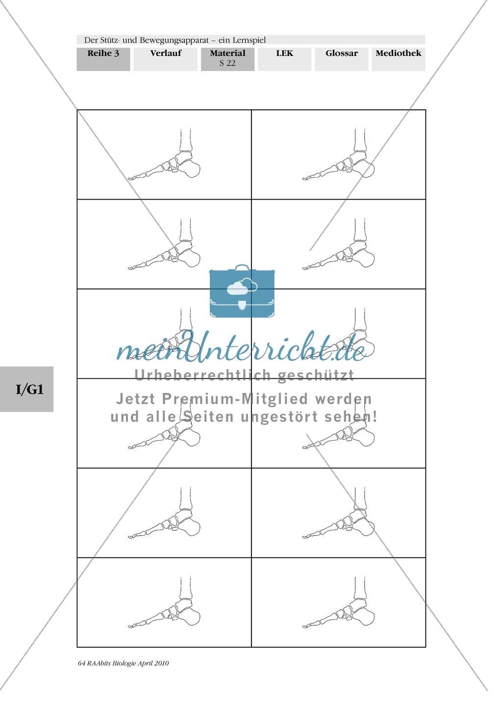 Lernspiel zum Stütz- und Bewegungsapparat: Spielanleitung, Spielfeld, Skelett-Puzzleteile, Fragen, Spielkarten, Röntgenbilder Kontrollbogen, Lösungsbogen Preview 21