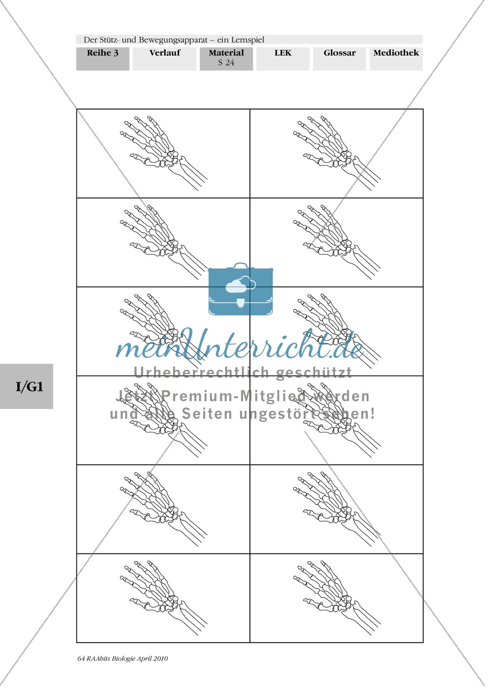 Lernspiel zum Stütz- und Bewegungsapparat: Spielanleitung, Spielfeld, Skelett-Puzzleteile, Fragen, Spielkarten, Röntgenbilder Kontrollbogen, Lösungsbogen Preview 23