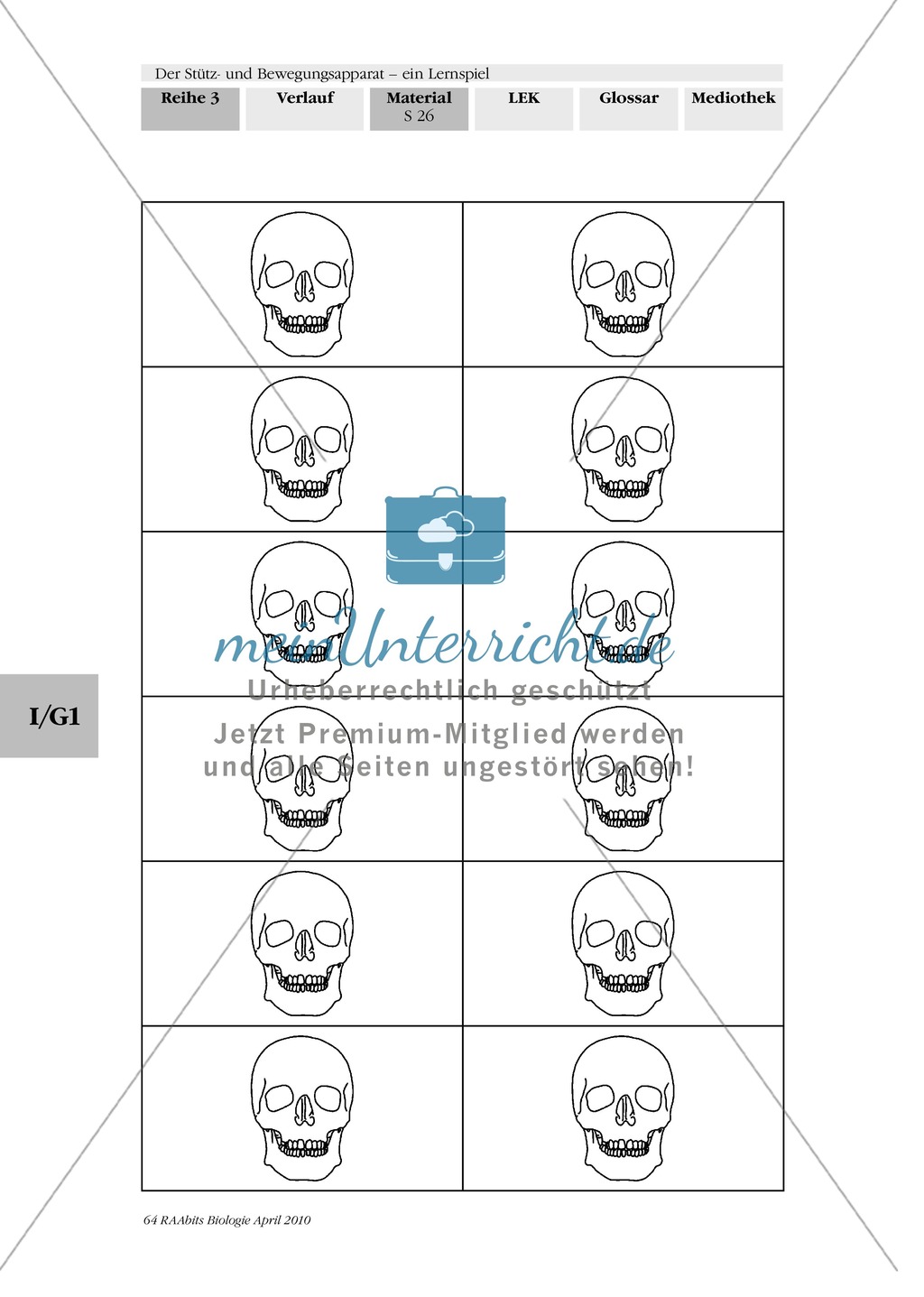 Lernspiel zum Stütz- und Bewegungsapparat: Spielanleitung, Spielfeld, Skelett-Puzzleteile, Fragen, Spielkarten, Röntgenbilder Kontrollbogen, Lösungsbogen Preview 25