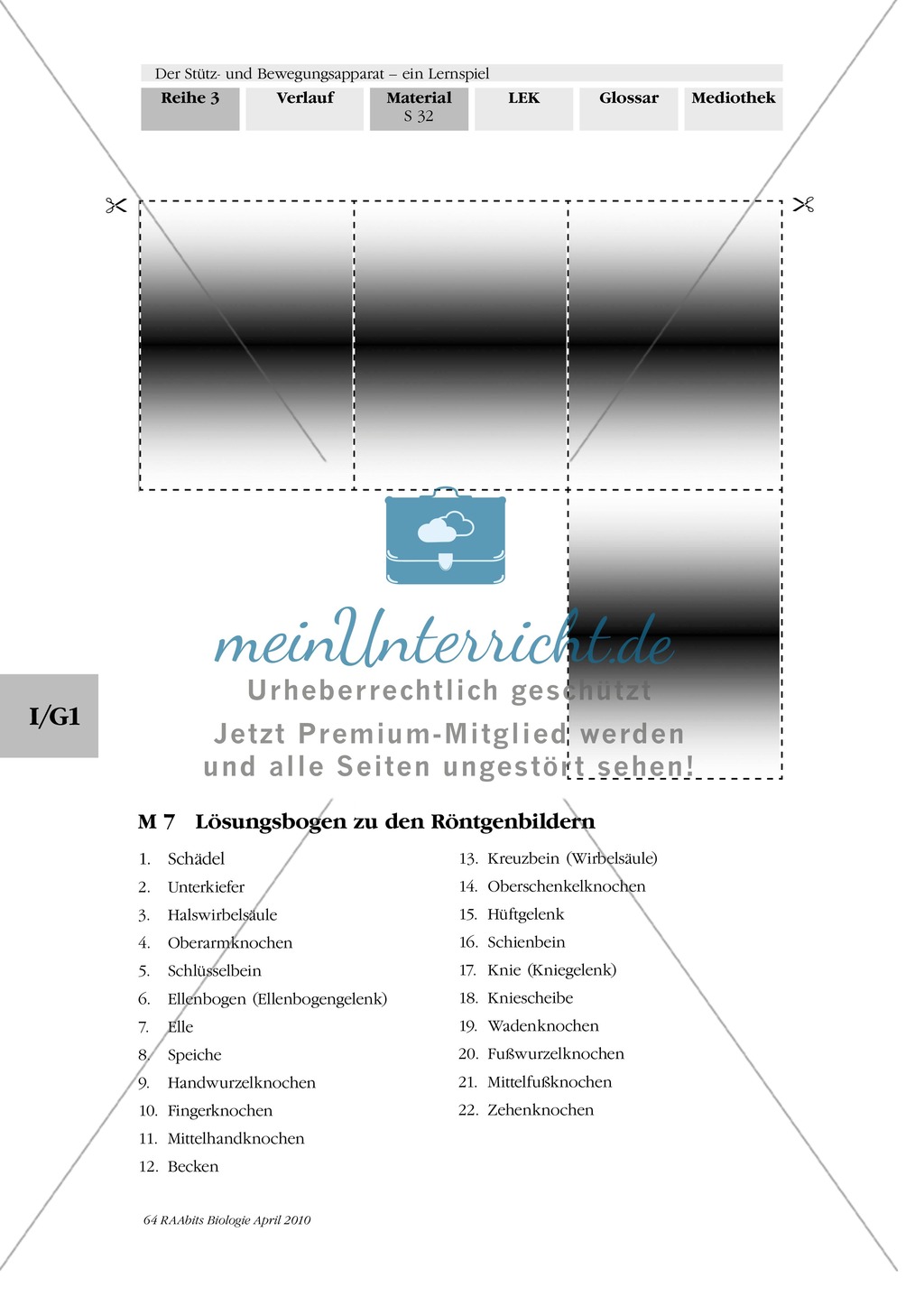 Lernspiel zum Stütz- und Bewegungsapparat: Spielanleitung, Spielfeld, Skelett-Puzzleteile, Fragen, Spielkarten, Röntgenbilder Kontrollbogen, Lösungsbogen Preview 31