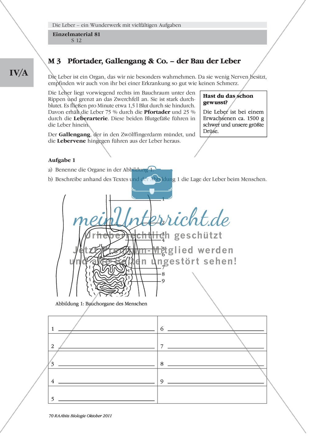 Bau der Leber: Beschriften Preview 5