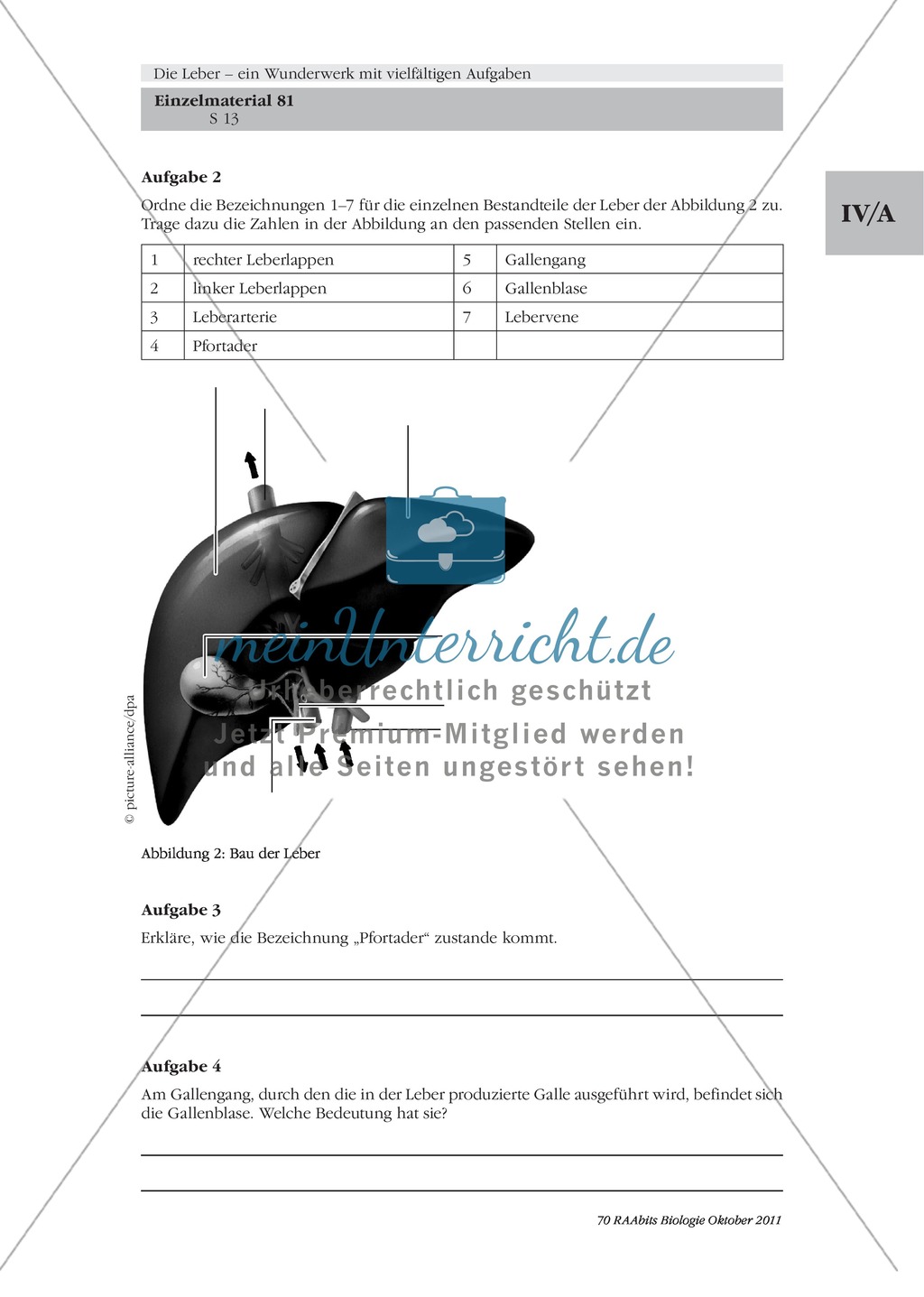 Bau der Leber: Beschriften Preview 6