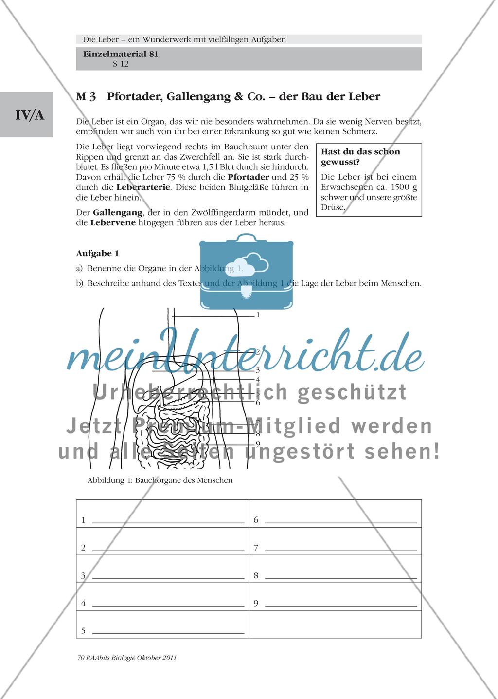 Folie mit Abbildungen zum Bau und Feinbau der menschlichen Leber / Pfortader, Gallengang & Co. – der Bau der Leber Preview 4