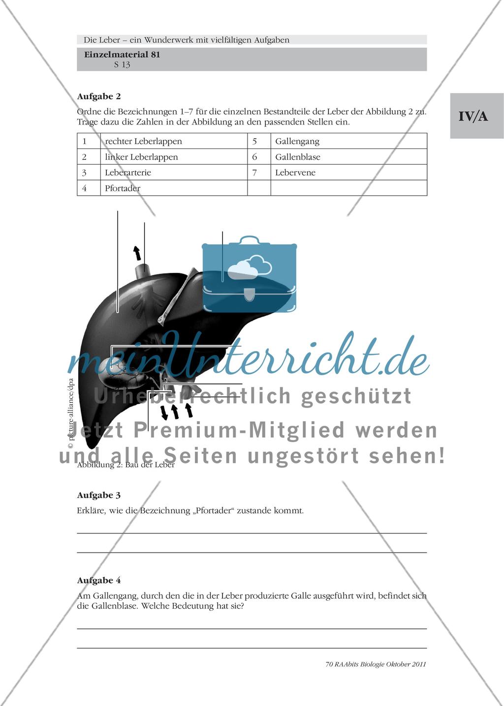 Folie mit Abbildungen zum Bau und Feinbau der menschlichen Leber / Pfortader, Gallengang & Co. – der Bau der Leber Preview 5