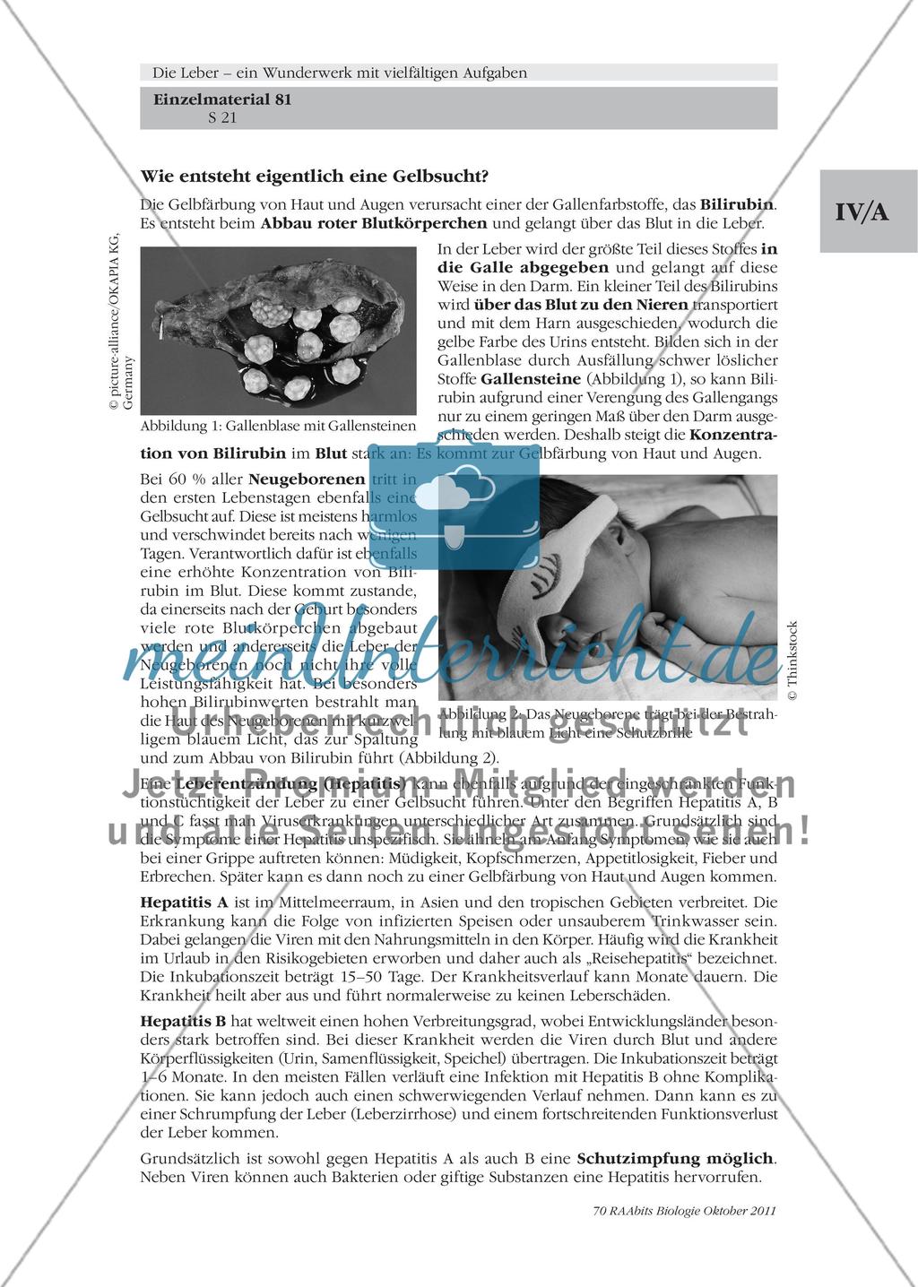 Die Leber – ein lebenswichtiges Stoffwechselorgan / Der Glucose-Stoffwechsel der Leber / Was hat es mit der Gallenflüssigkeit auf sich? Preview 5