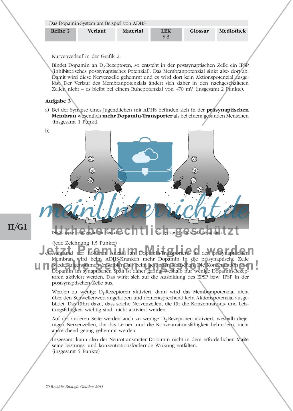 Was steckt hinter dem Dopamin-System? – Testen Sie Ihr Wissen! Preview 3