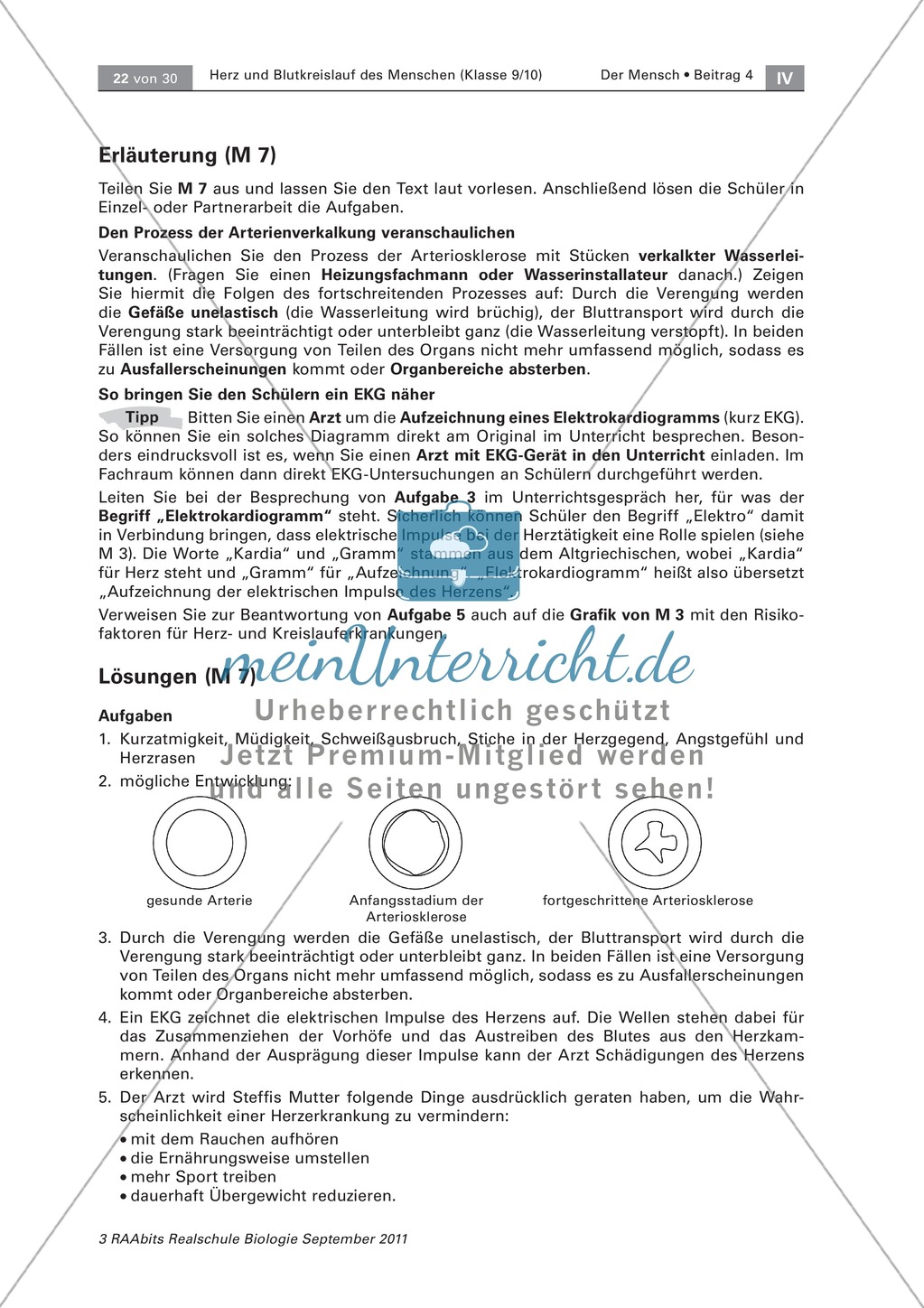 Herz- und Kreislauferkrankungen:Text, Zeichnen Preview 2