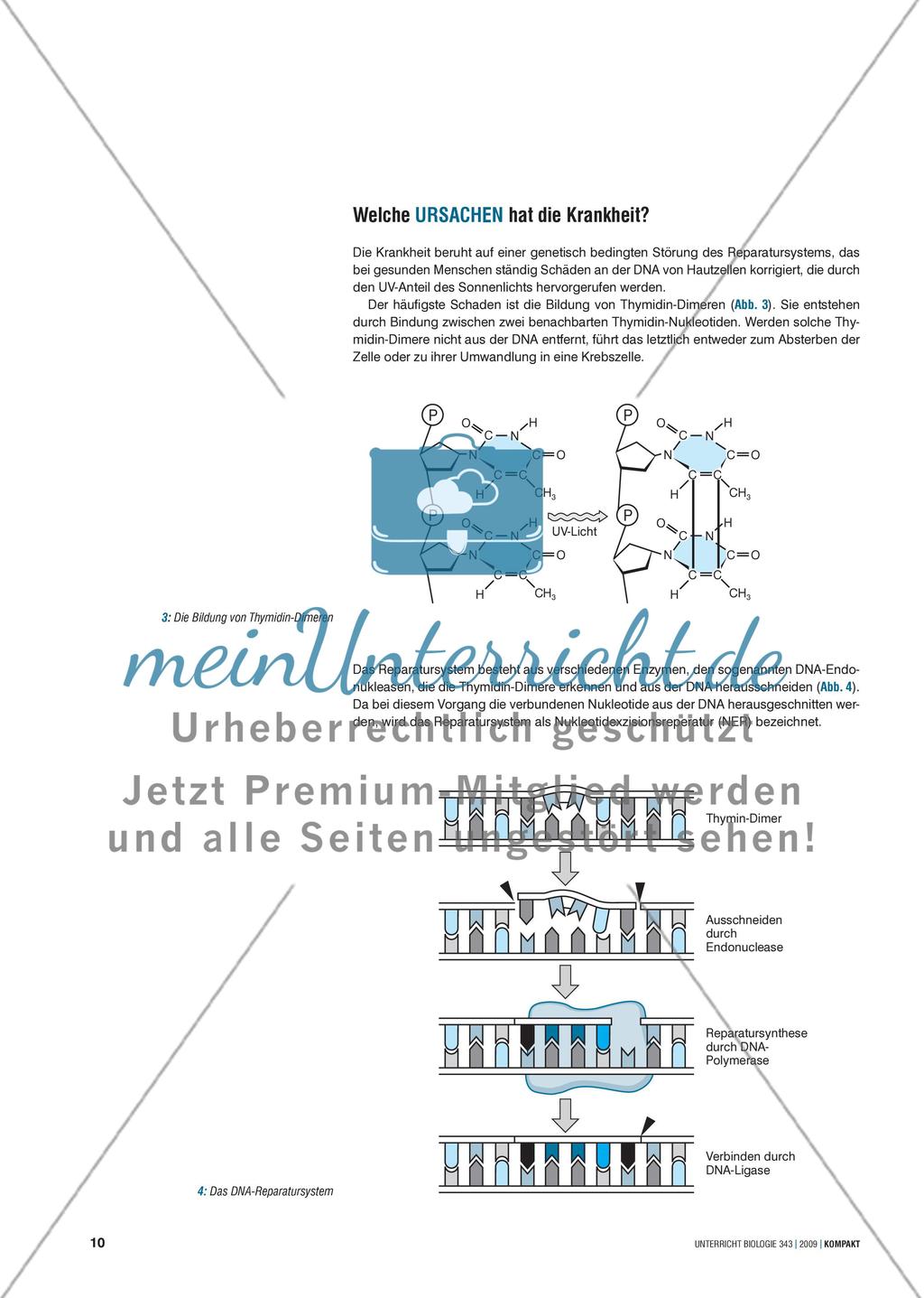 Genetik: Untersuchung der erblich bedingten Krankheit Xeroderma pigmentosum (