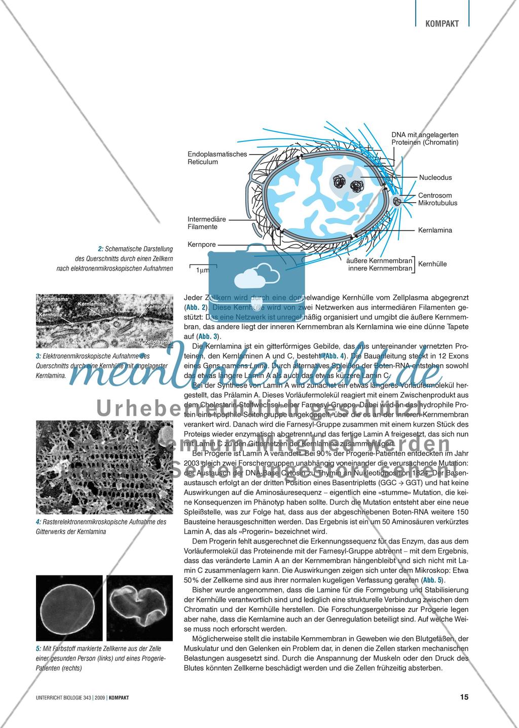 Genetik: Untersuchung erblich bedingter Erkrankungen des Herz-Kreislaufsystems am Beispiel der Progerie Preview 2