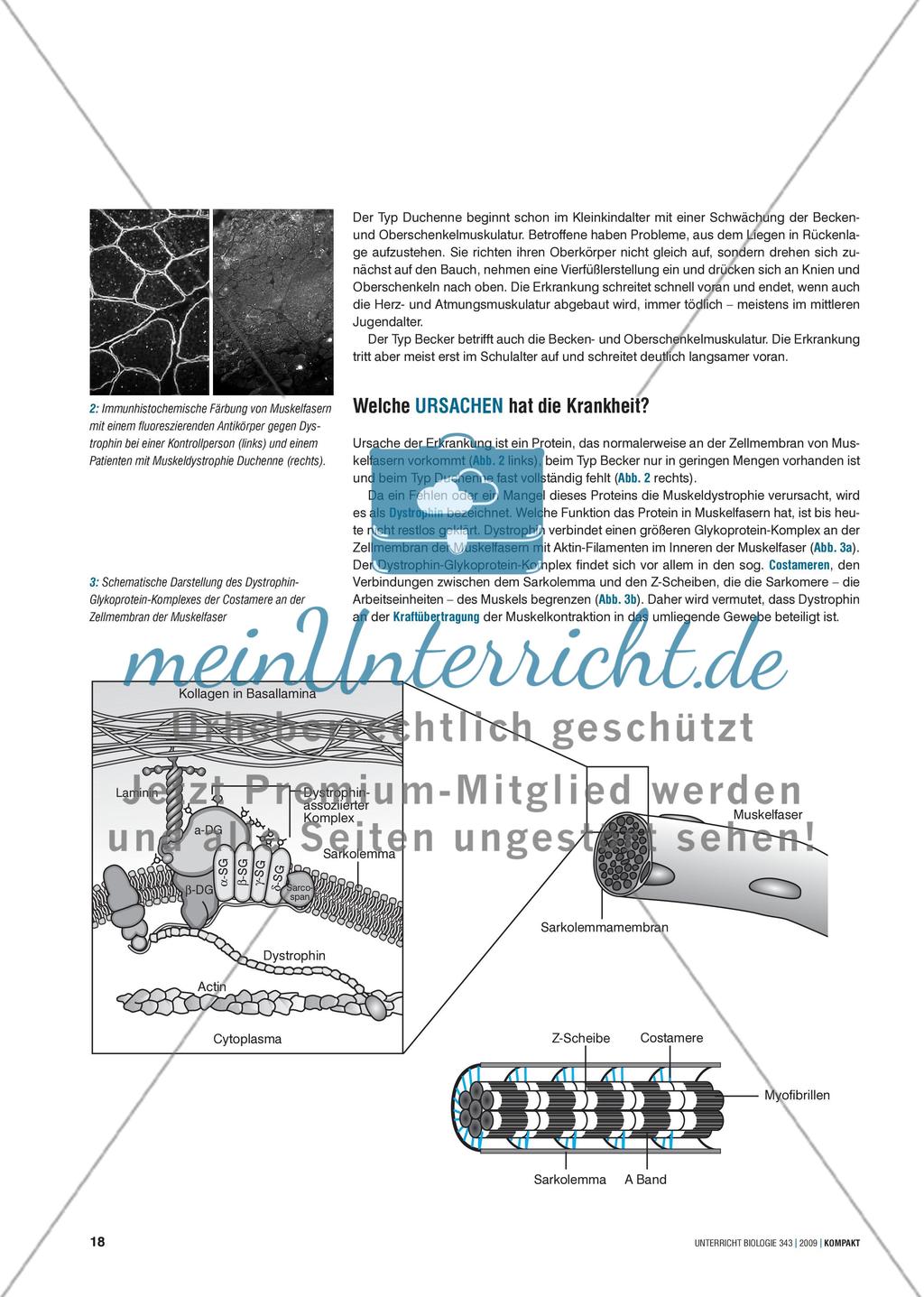 Genetik: Untersuchung erblich bedingter Erkrankungen der Muskulatur am Beispiel der Muskeldystrophie Preview 2