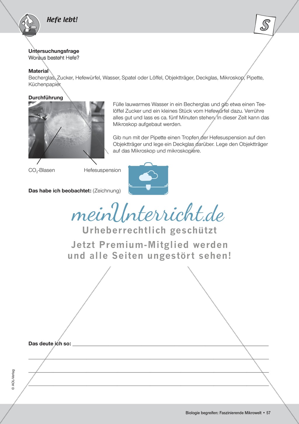 Wie Kleinstlebewesen am täglichen Leben beteiligt sind am Beispiel der Hefe - ein Versuch Preview 3